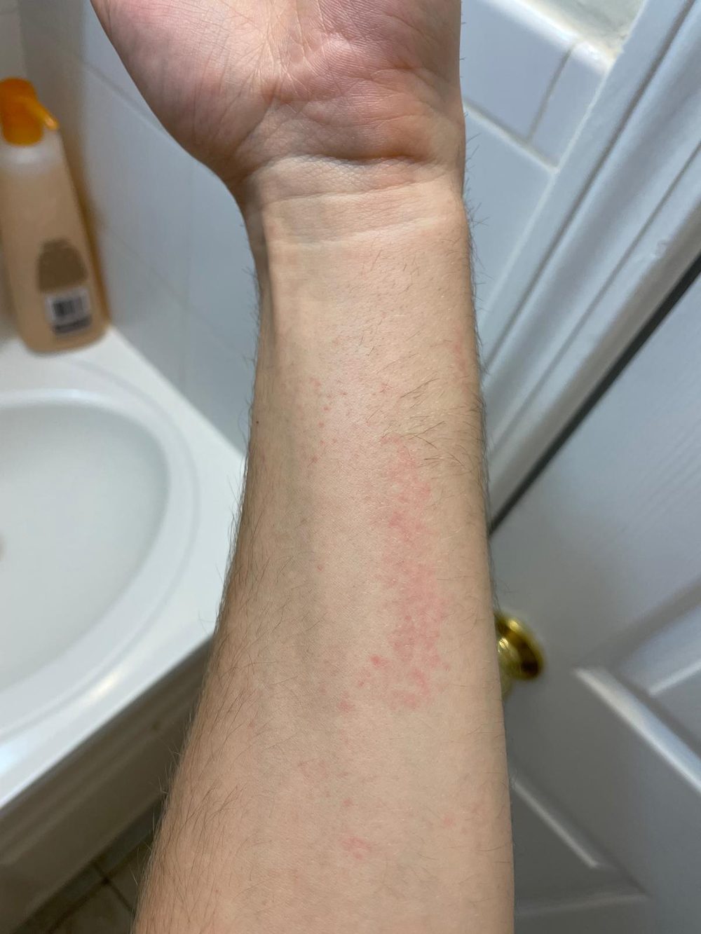 Forearm skin covered in scattered small red dots beneath the surface.