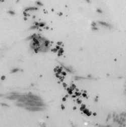 Electron micrograph showing scattered dense dark particles within a tissue sample.